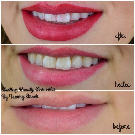 Permanent makeup lips by Lasting Beauty Cosmetics